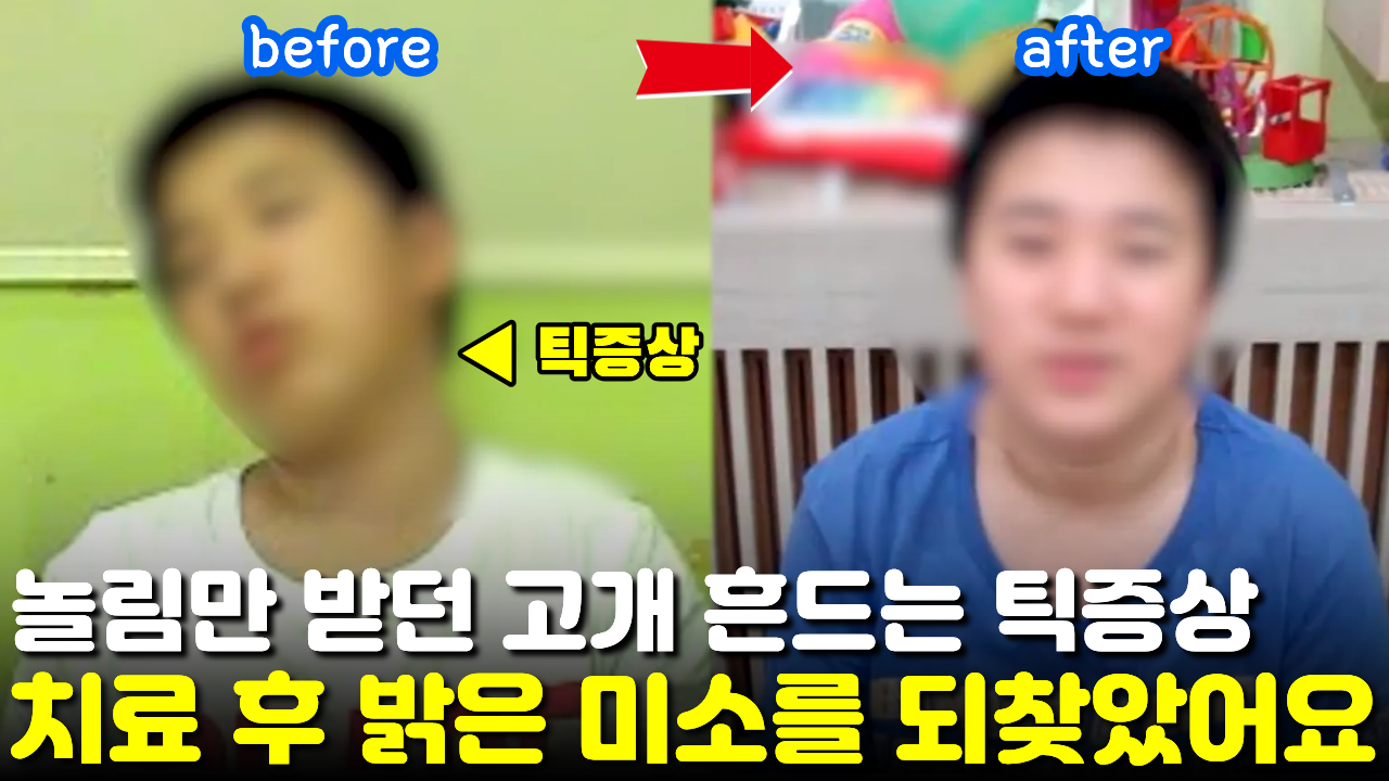 [치료 전후]  틱장애 치료 1년, 대학병원 정신과에서 치료 포기했던 뚜렛증후군 완전히 좋아졌어요