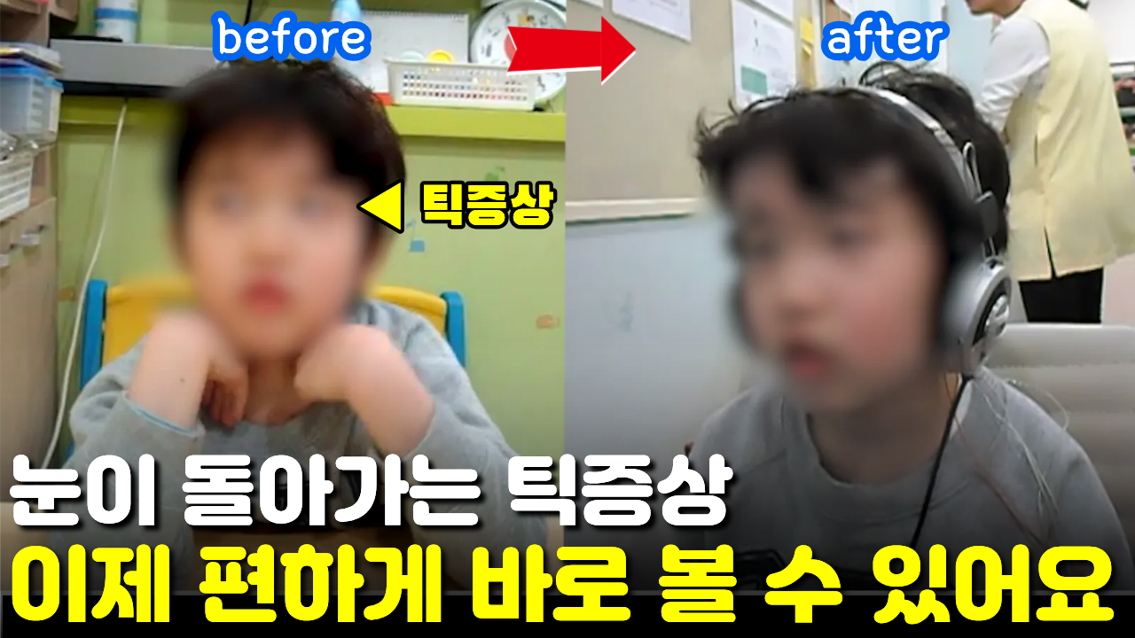 [치료 전후]  눈이 돌아가는 눈 틱장애, 4개월 치료 후 틱증상 개선되었어요